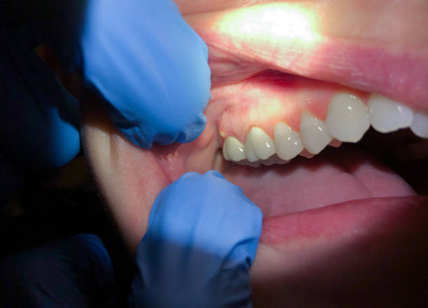 Best Emergency Denture Repair in Monte Vista, CO